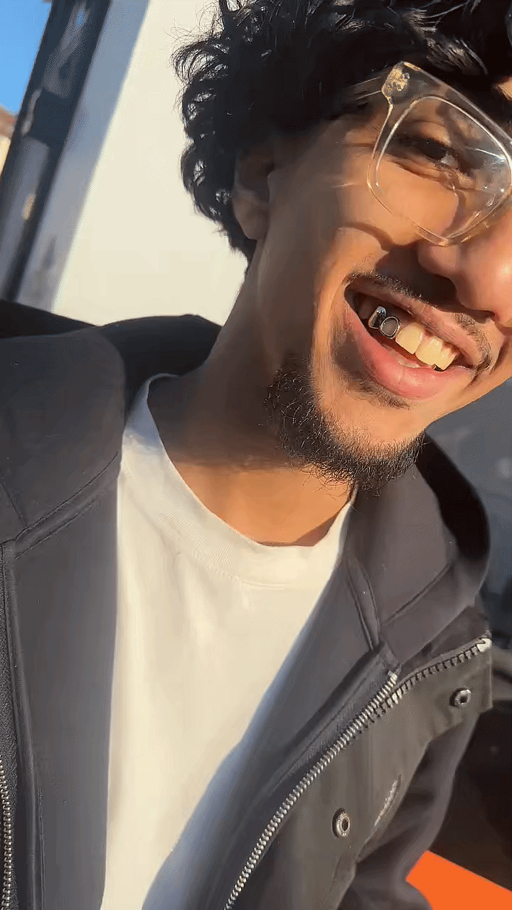 Dental silver cainine and incisor