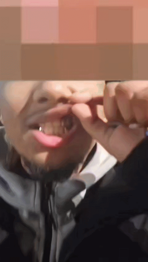 Silver incisors