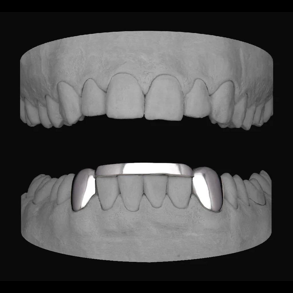 2x Canines & Bar (Lower)