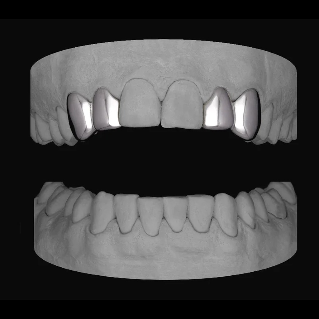 2x Lateral & Canine (4 Caps)