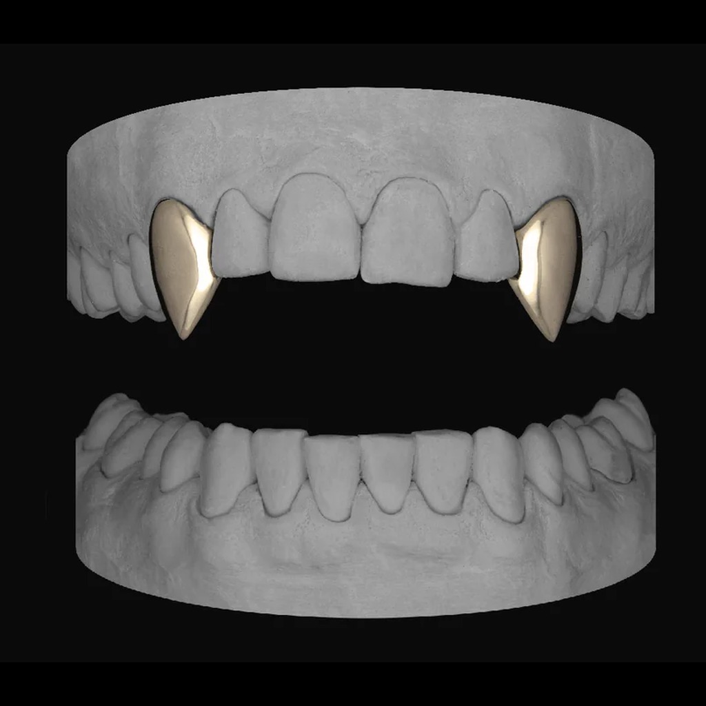 Gold vampire canine grillz on dental mould
