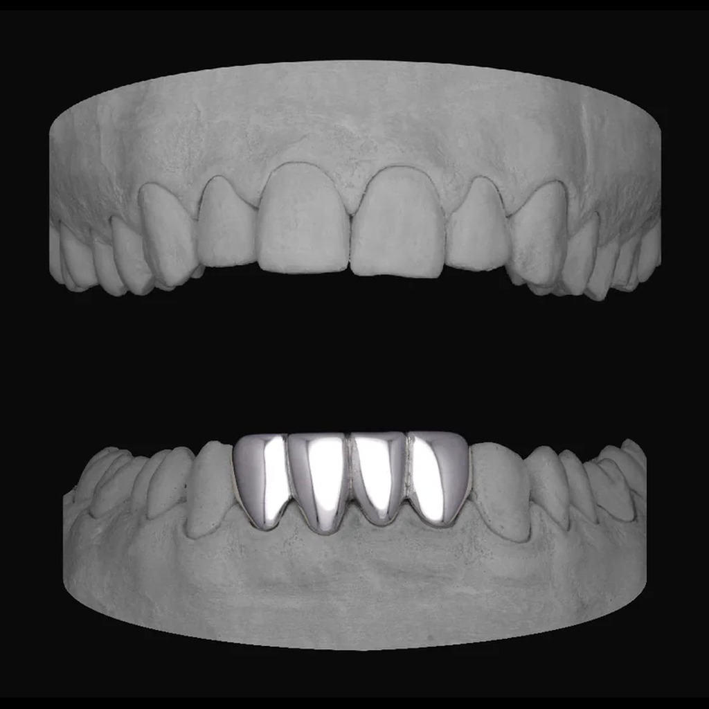 4 Set (Lower)
