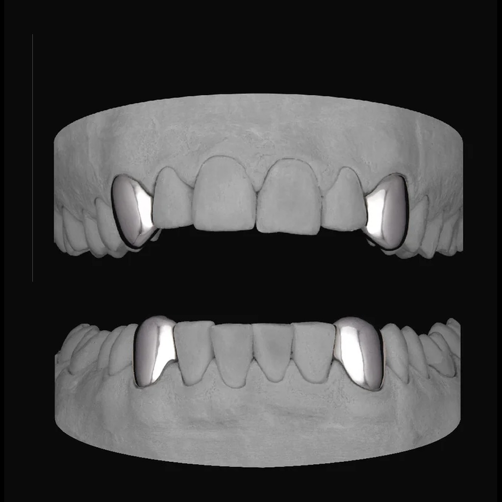 4x Canines (Top & Bottom)