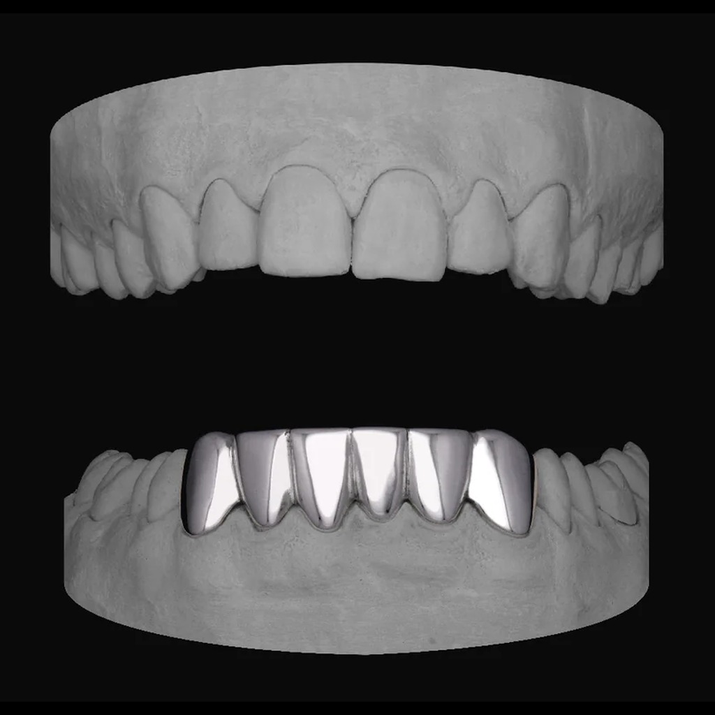6 Set