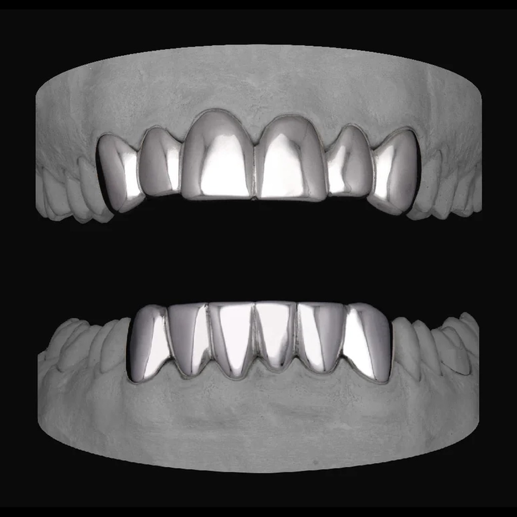 6 Set Upper + 6 Set Lower (12 Caps)