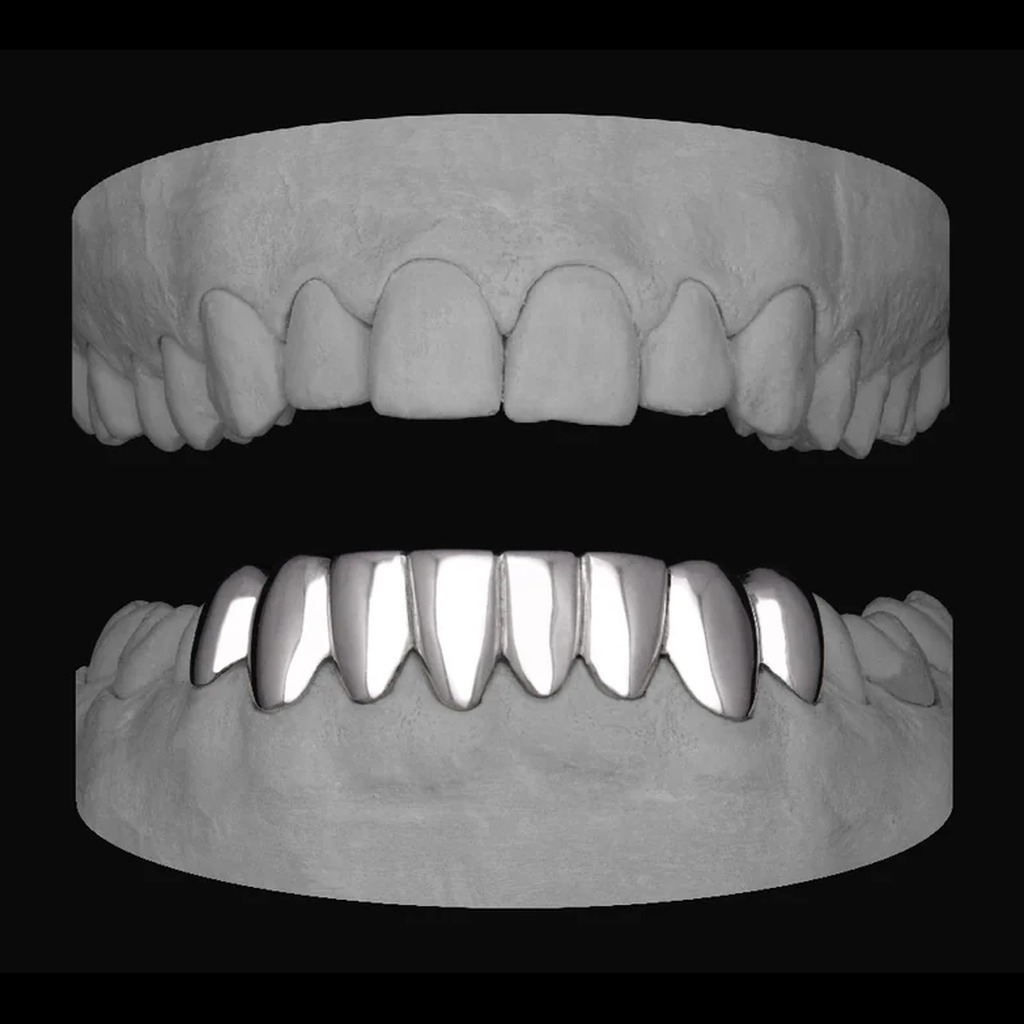 8 Set (Lower)