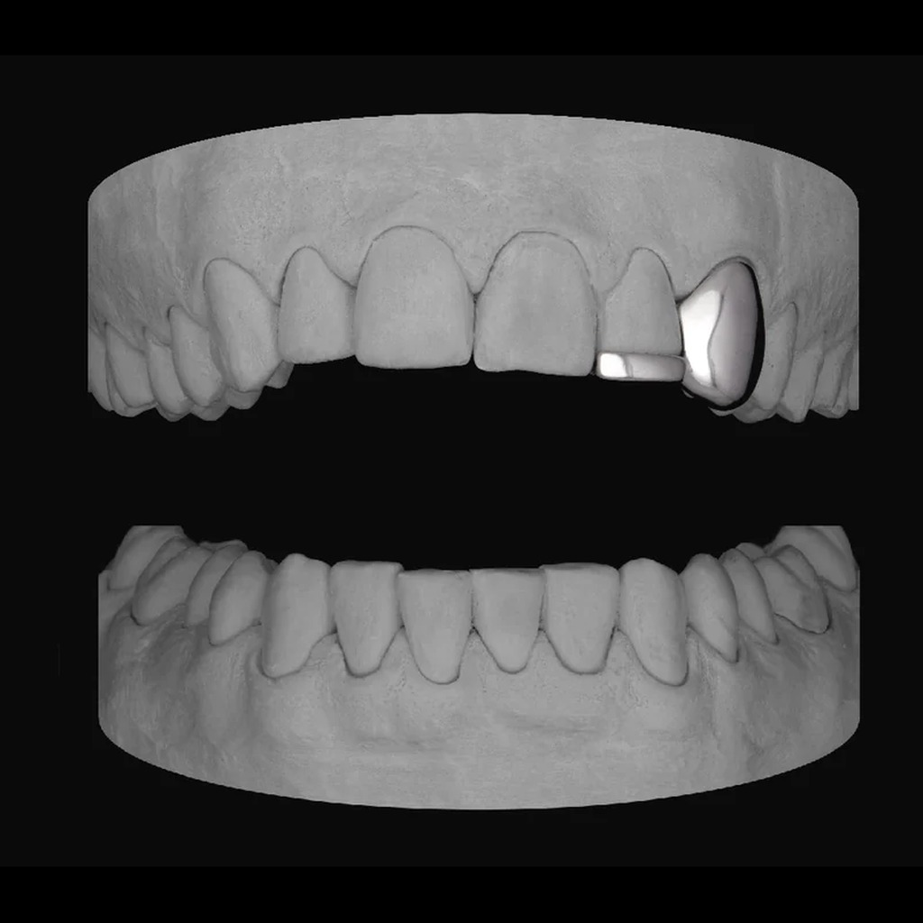 Canine with Bar Accent