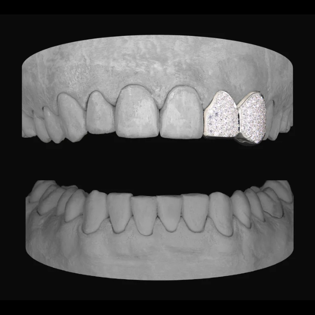 Diamond Lateral & Canine