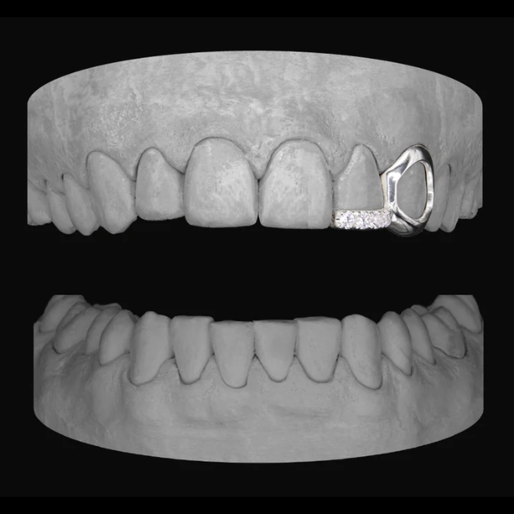 Diamond Window Canine & Bar Lateral