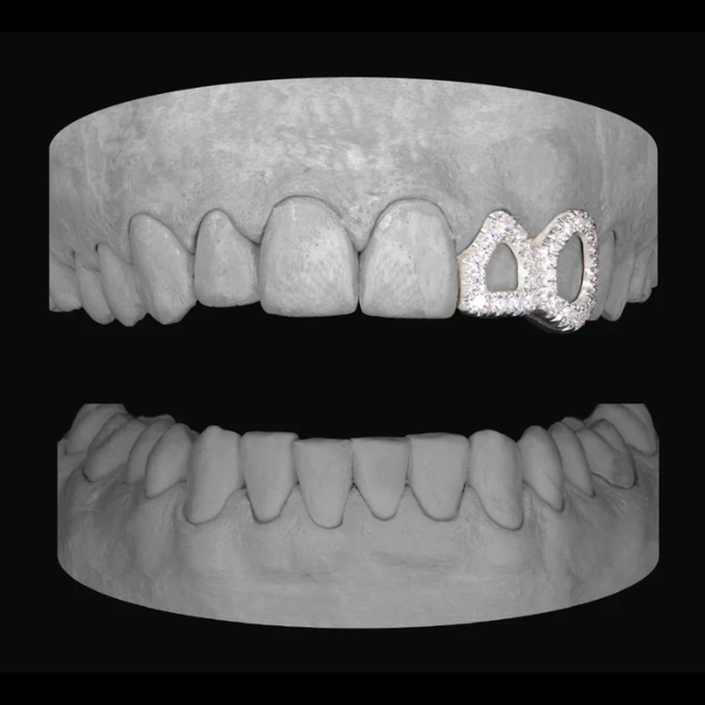 Diamond Window Lateral & Canine