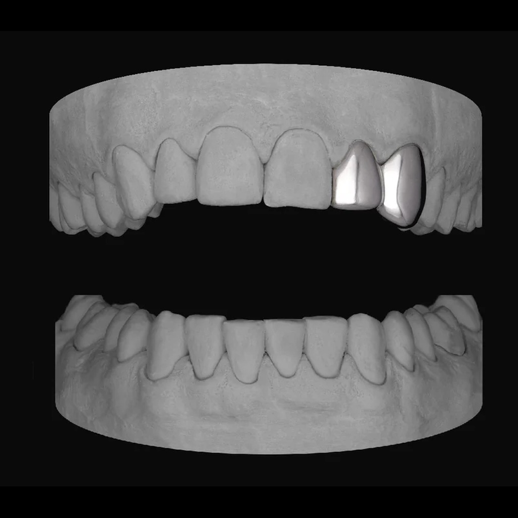 Lateral & Canine